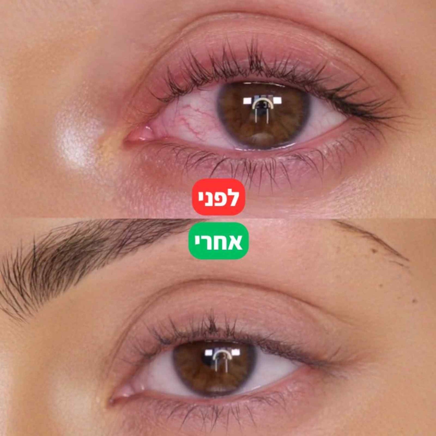 LAVEN Eye Light - הטיפול המוביל בישראל להקלה על יובש ואדמומיות