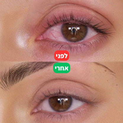 LAVEN Eye Light - הטיפול המוביל בישראל להקלה על יובש ואדמומיות